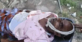কুষ্টিয়ায় হাসপাতাল থেকে কাটা পা গায়েব, পা ছাড়াই দাফন!